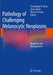 Pathology of Challenging Melanocytic Neoplasms: Diagnosis and Management by Christopher R. Shea
