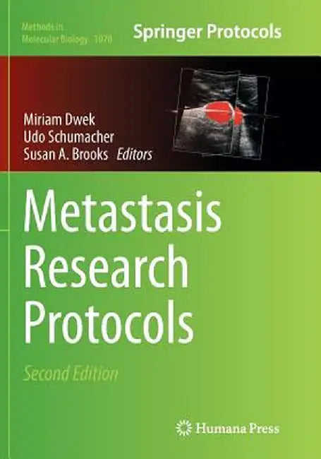 Metastasis Research Protocols by Miriam Dwek