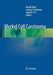 Merkel Cell Carcinoma by Murad Alam