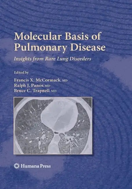 Molecular Basis of Pulmonary Disease: Insights from Rare Lung Disorders by Francis X. McCormack
