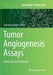 Tumor Angiogenesis Assays: Methods and Protocols by Domenico Ribatti