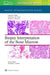 Biopsy Interpretation of the Bone Marrow: Print + eBook with Multimedia by Laura M. Wake, Genevieve M. Crane, Michael Joseph Borowitz