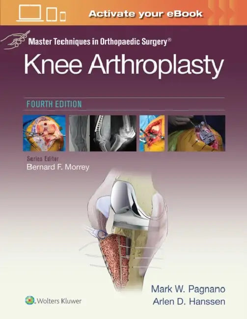 Master Techniques in Orthopedic Surgery: Knee Arthroplasty by Mark W. Pagnano