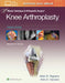 Master Techniques in Orthopedic Surgery: Knee Arthroplasty by Mark W. Pagnano