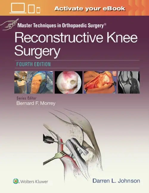 Master Techniques in Orthopaedic Surgery: Reconstructive Knee Surgery by Darren L. Johnson