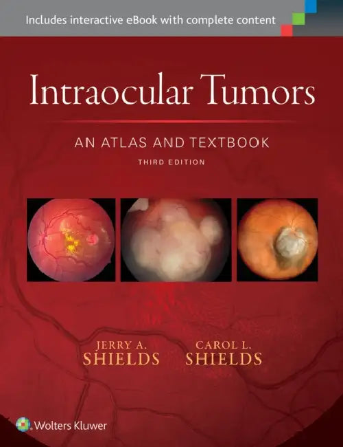 Intraocular Tumors: An Atlas and Textbook: Volume 1 by Jerry A. Shields, Carol L. Shields