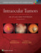 Intraocular Tumors: An Atlas and Textbook: Volume 1 by Jerry A. Shields, Carol L. Shields