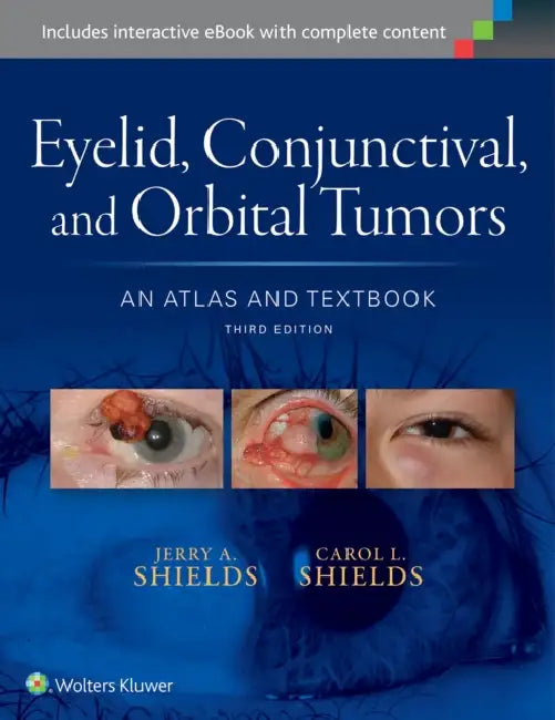 Eyelid, Conjunctival, and Orbital Tumors: An Atlas and Textbook by Jerry A. Shields, Carol L. Shields