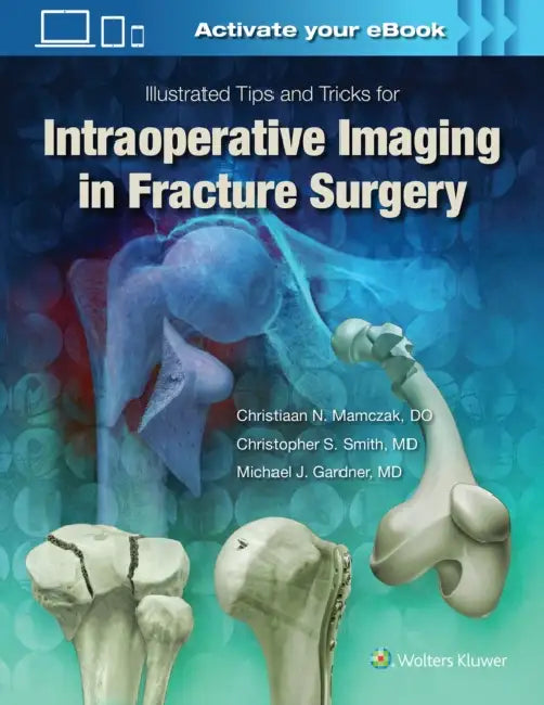 Illustrated Tips and Tricks for Intraoperative Imaging in Fracture Surgery by Michael J. Gardner
