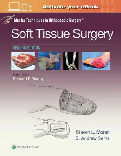 Master Techniques in Orthopaedic Surgery: Soft Tissue Surgery by Steven Moran