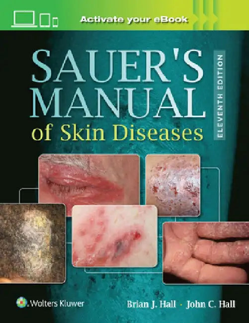 Sauer's Manual of Skin Diseases by John C. Hall