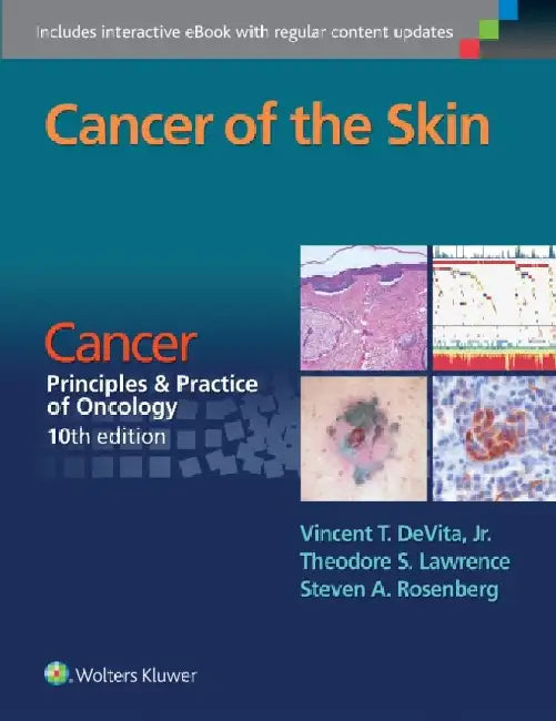 Cancer of the Skin: Cancer: Principles & Practice of Oncology, 10th Edition by Vincent T. Devita