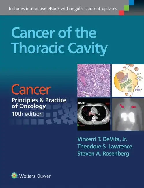 Cancer of the Thoracic Cavity: Cancer: Principles & Practice of Oncology, 10th Edition by Vincent T. Devita