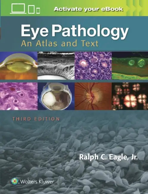 Eye Pathology: An Atlas and Text by Jr. Eagle Ralph C.