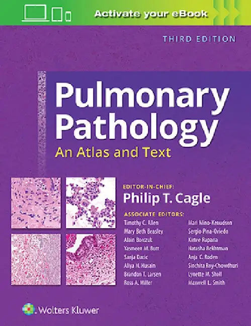 Pulmonary Pathology: An Atlas and Text by Philip T. Cagle