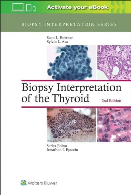 Biopsy Interpretation of the Thyroid by Scott L. Boerner, Sylvia L. Asa
