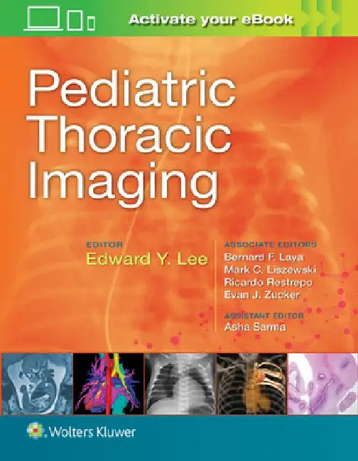 Pediatric Thoracic Imaging by Edward Y. Lee