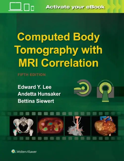 Computed Body Tomography with MRI Correlation by Edward Y. Lee, Andetta Hunsaker, Bettina Siewert