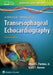A Practical Approach to Transesophageal Echocardiography by Albert C. Perrino