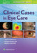 Clinical Cases in Eye Care by Mark Rosenfield