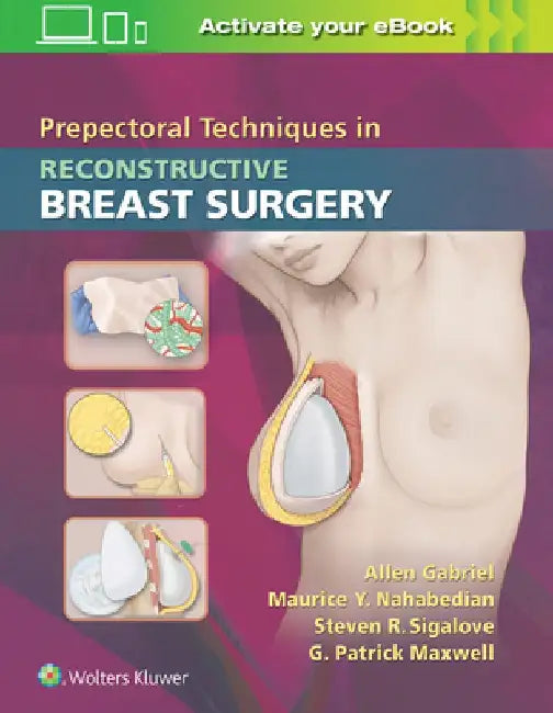 Prepectoral Techniques in Reconstructive Breast Surgery by Allen Gabriel