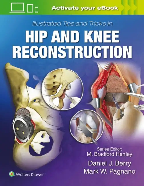 Illustrated Tips and Tricks in Hip and Knee Reconstructive and Replacement Surgery by Daniel J. Berry, Mark W. Pagnano
