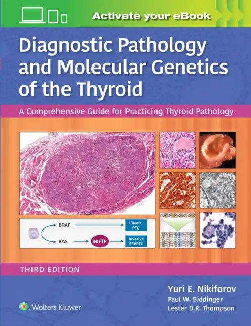 Diagnostic Pathology and Molecular Genetics of the Thyroid: A Comprehensive Guide for Practicing Thyroid Pathology by Yuri E. Nikiforov, Paul W. Biddinger, Lester D. R. Thompson