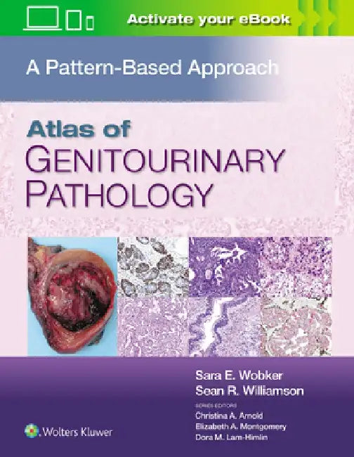 Atlas of Genitourinary Pathology: A Pattern Based Approach by Sara E. Wobker