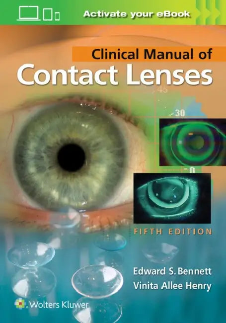 Clinical Manual of Contact Lenses by Edward S. Bennett, Vinita Allee Henry