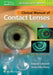 Clinical Manual of Contact Lenses by Edward S. Bennett, Vinita Allee Henry