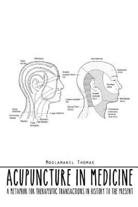 Acupuncture in Medicine: A Metaphor for Therapeutic Transactions in History to the Present by Moolamanil Thomas