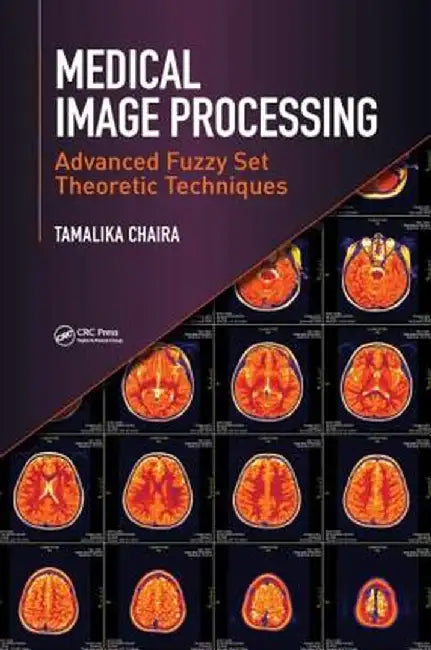 Medical Image Processing: Advanced Fuzzy Set Theoretic Techniques by Tamalika Chaira