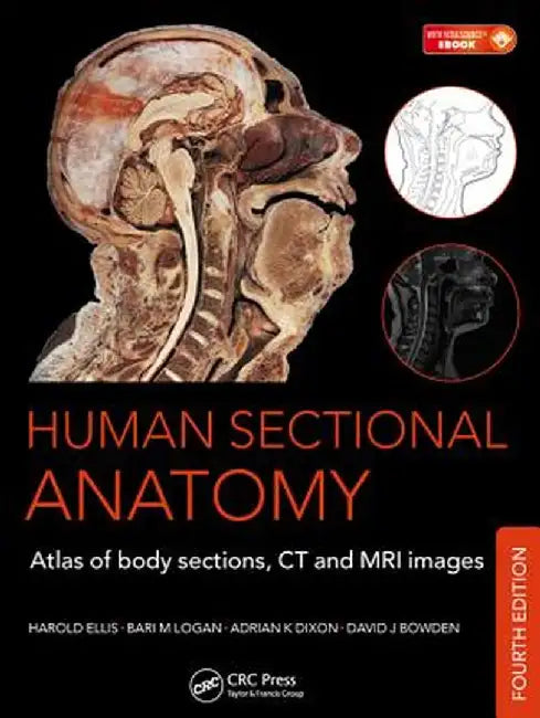 Human Sectional Anatomy: Atlas of Body Sections, CT and MRI Images by Adrian K. Dixon