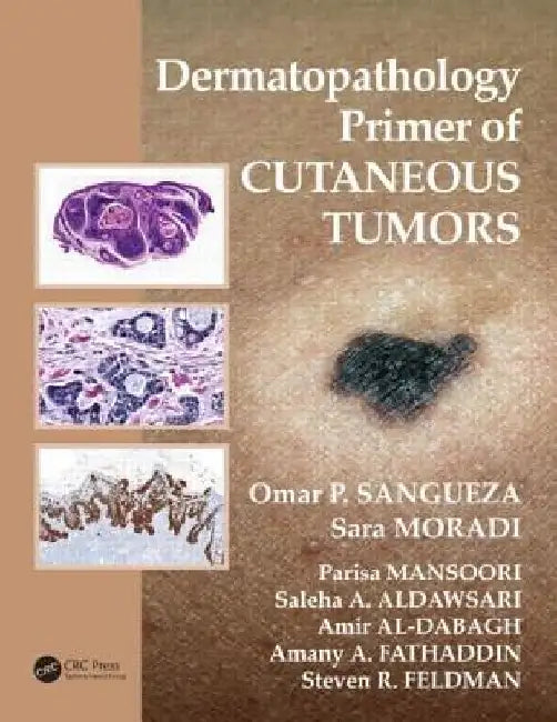 Dermatopathology Primer of Cutaneous Tumors by Omar P. Sangueza