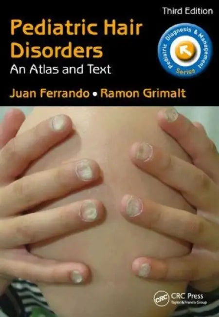 Pediatric Hair Disorders: An Atlas and Text, Third Edition by Juan Ferrando
