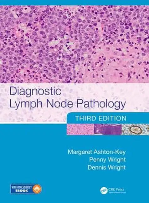 Diagnostic Lymph Node Pathology by Margaret Ashton-Key