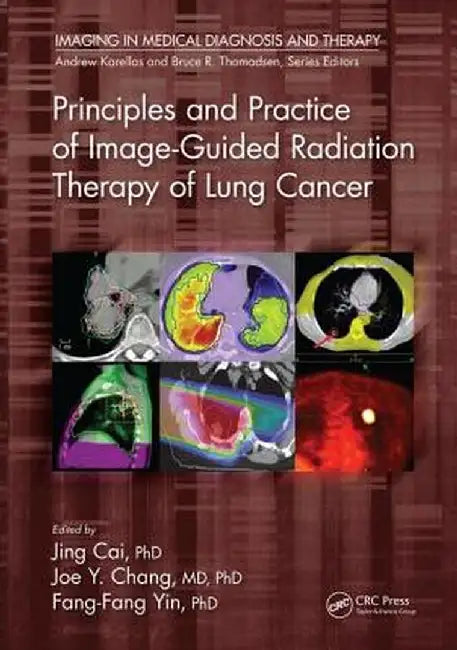 Principles and Practice of Image-Guided Radiation Therapy of Lung Cancer by Jing Cai