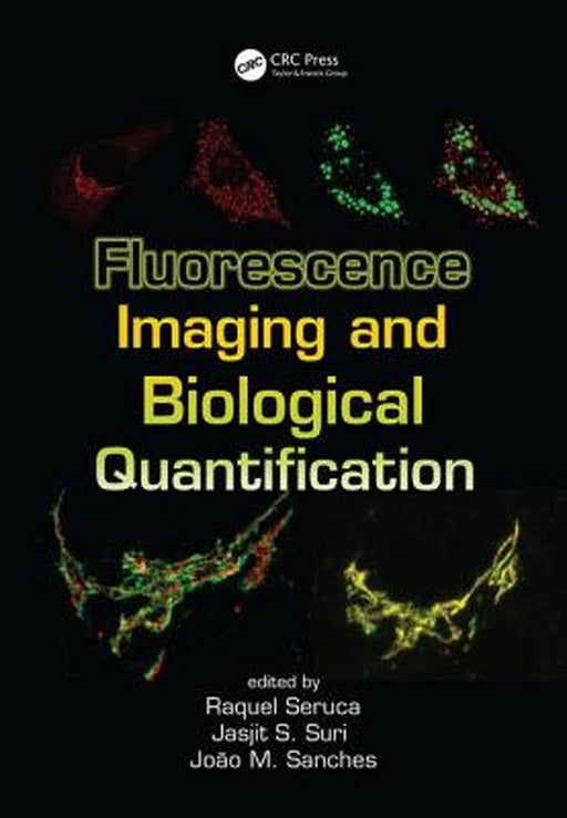 Fluorescence Imaging and Biological Quantification by Jasjit S. Suri, J. Miquel Sanches