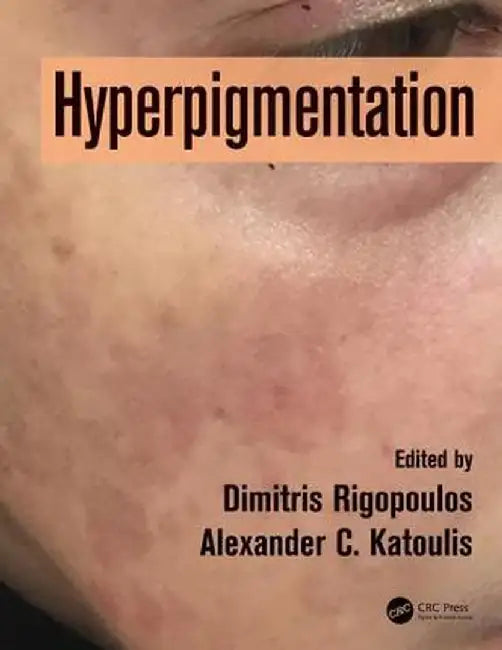 Hyperpigmentation by Dimitris Rigopoulos