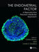 The Endometrial Factor: A Reproductive Precision Medicine Approach by Carlos Simón