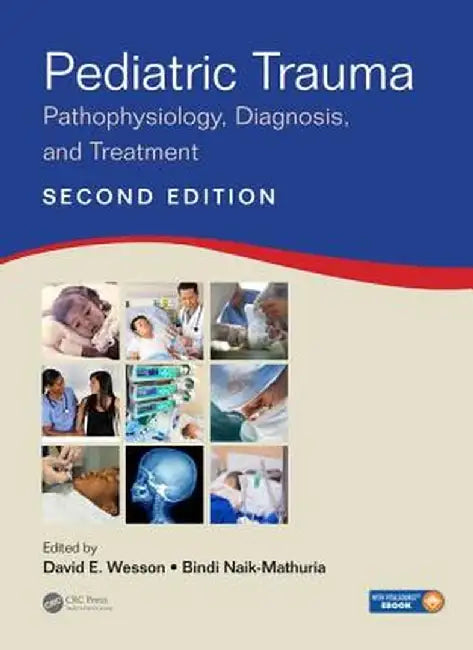 Pediatric Trauma: Pathophysiology, Diagnosis, and Treatment, Second Edition by David E. Wesson