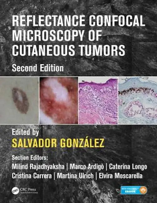 Reflectance Confocal Microscopy of Cutaneous Tumors by Salvador Gonzalez