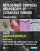 Reflectance Confocal Microscopy of Cutaneous Tumors by Salvador Gonzalez