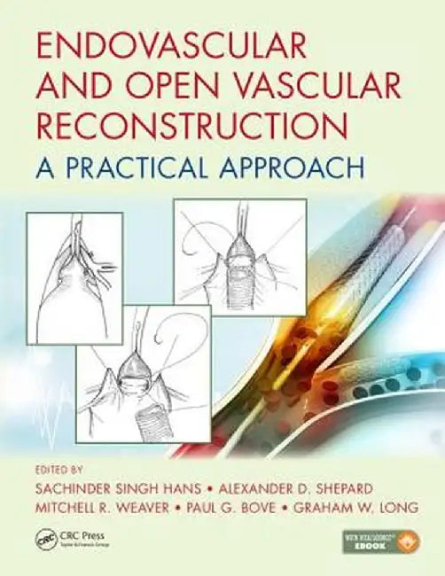 Endovascular and Open Vascular Reconstruction: A Practical Approach by Sachinder Singh Hans
