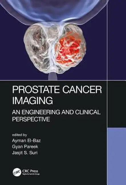 Prostate Cancer Imaging: An Engineering and Clinical Perspective by Ayman El-Baz