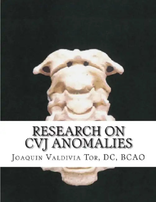 Research on CVJ anomalies by Joaquin Valdivia Tor