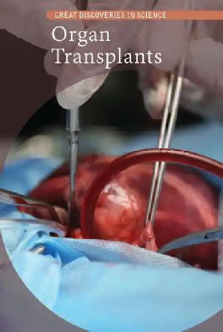 Organ Transplants by Cathleen Small
