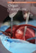 Organ Transplants by Cathleen Small