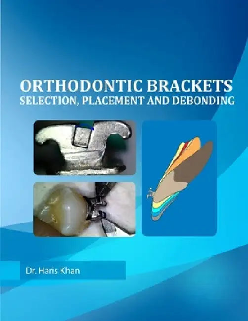 Orthodontic Brackets: Selection, Placement and Debonding by Haris Khan