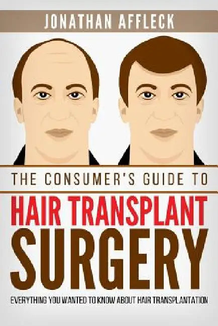 The Consumer's Guide to Hair Transplant Surgery: Everything You Wanted to Know About Hair Transplantation by Jonathan Affleck